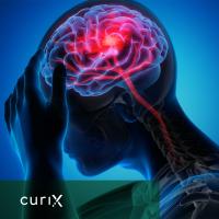 Curix, part of the Demcon Group, is working on groundbreaking technology for the treatment of neurological diseases