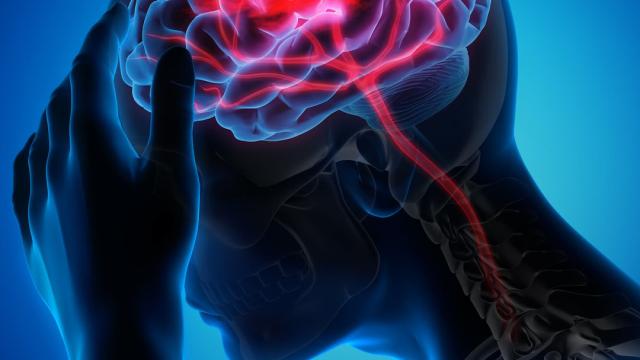 Curix, onderdeel van de Demcon group, werkt aan baanbrekende technologie voor de behandeling van hersenziekten