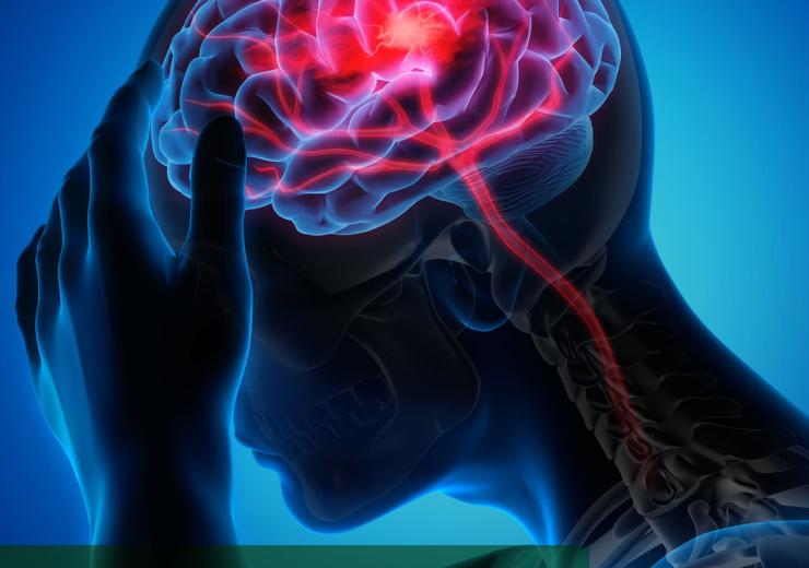 Curix, part of the Demcon Group, is working on groundbreaking technology for the treatment of neurological diseases